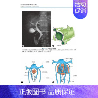 [正版]肝脏疾病诊断精要 原书第2版 (日)桥本裕子 等 著 杨松,邢卉春,陈效友 译 内科学医师参考资料图书 医学类书