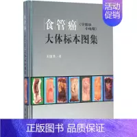 [正版]食管癌早期和中晚期大体标本图集 王国清 内科学医生医师临床诊断治疗专业书籍 医学类图书 科学出版
