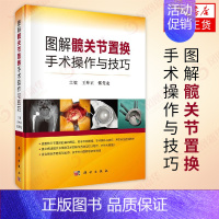 [正版]图解髋关节置换手术操作与技巧 王坤正张先龙 科学出版社 解析解读 图文并茂骨科医学卫生 外科学类书籍凤凰书店