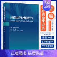 [正版]肿瘤治疗影像学评价 李军 人民卫生出版社 是临床肿瘤内 外科专家 影像肿瘤专家多学科合作的通用语言 癌症治疗 癌