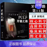 [正版]牙髓之路第十一版第11版 牙体牙髓病学临床牙髓再生技术口腔书籍医学类专业书籍牙科治疗根管图谱辽宁科技97