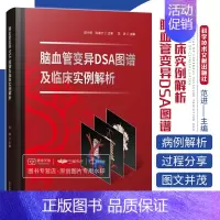 [正版]脑血管变异DSA图谱及临床实例解析 范进主编 针对神经介入中脑血管变异 针对脑血管变异手术策略 医学类丛书 科学