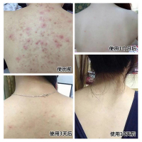 清爽控油男女全身香皂羊奶去除螨虫洁洗面控油去痘背部毛孔 一盒(净重100克收藏送起泡网)