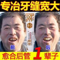 [刷完严丝合缝]牙缝宽修复牙齿松动牙根暴露牙龈萎缩固齿牙膏 一盒试用装