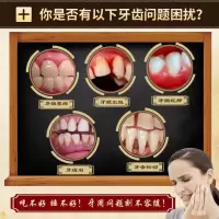 修正牙齿松动牙龈萎缩修复出血肿痛固齿散防蛀牙修复牙洞喷剂