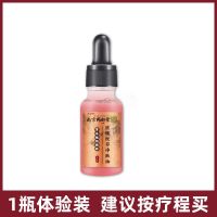 [去黑点神器]南京同仁堂祛斑祛痣痘玫瑰精油点痣无痕黑色素男女 [南京同仁堂]无痛去痣祛斑 1瓶装[体验装]