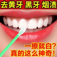 去黄牙渍结石烟牙垢牙斑净牙齿美白脱色剂神器洗牙粉 [多买多送]