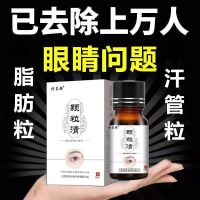 颗粒清去脂肪粒汗管粒油脂粒神器眼部脸部祛除膏眼霜精华男女专用 1盒体验装棉签