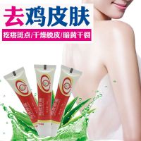【送退货险】奇力康鸡皮肤霜软化毛囊堵塞去除胳膊鸡皮毛囊角化霜 3支装(无盒装)