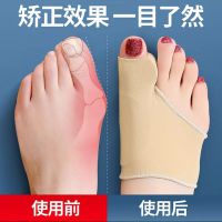 拇外翻矫正器成人大脚骨儿童大拇指男女脚趾头可穿鞋日夜用脚部 日用升级款一只装[不分左右脚] S码[33-35码脚穿戴]