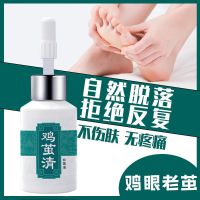 去鸡眼贴老茧去除脚茧脚趾去老茧脚茧脚底老茧手上老茧厚茧鸡眼膏 5ML试用装[不含外包装]
