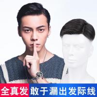 假发男韩版帅气男士假发头顶补发片前额补发秃顶补发块真发假发片 黑色