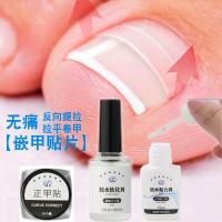 甲沟嵌甲矫正器贴片 正甲贴 脚趾甲矫正甲贴片 矫正帖 卷甲贴10片 10片装无胶水(买2送1)+送5件套