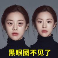 一盒/补水去黑眼圈 [脂肪粒]蛇毒眼霜快速去除黑眼圈眼袋脂肪粒男女提拉紧致神器