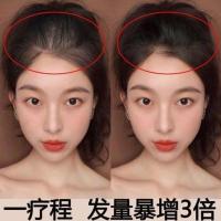 1瓶(体验装) 生发液增发密发秃顶发际线防脱育发液生发剂学生变长快速生长液