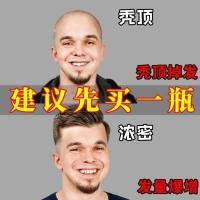 体验装[1瓶] 生发液头发快速生长液秃顶发际线增发密发脱发育发生发剂护发精油