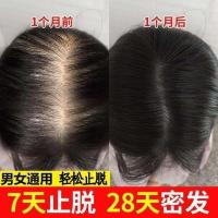 1瓶(体验装) 生发液秃顶头发快速生长液发际线增长液脂溢性增发密发防脱育发液