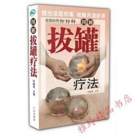 正版图解拔罐养生疗法全书 拔火罐自然疗法 中医养生穴位按摩书籍