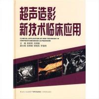 超声造影新技术临床应用-郑荣琴等主编-广州:广东科技出版社