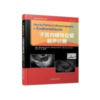正版 子宫内膜异位症超声诊 中国科学技术大学出版社 书籍