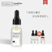 【买2送1】寡肽原液快速祛痘青春痘淡化痘印痘疤痘坑去痘霜精华液 寡肽原液祛痘精华液