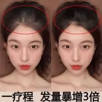 生发液增发密发秃顶发际线防脱育发液生发剂学生变长快速生长液 1瓶(体验装)