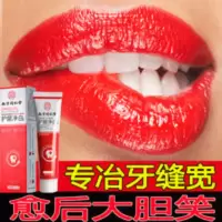 牙膏牙缝宽大牙龈萎缩松动吃饭塞牙修护牙齿敏感牙周固齿护龈牙膏 160mL