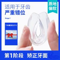 佰魅伊人牙套牙齿矫正透明隐形器龅牙神器整牙箍夜间保持器地包天 佰魅伊人正畸定位器 1阶段[适用于严重错位]