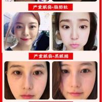 蛇毒眼霜 一瓶装【无赠品】 南京同仁堂眼霜去淡化黑眼圈眼袋抗皱细纹男女士紧致熬夜补水保湿