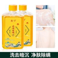 其他 560ml 瓦估店铺39元4瓶童兮硫磺除螨液体香皂祛痘净肤水润控 快起量小店