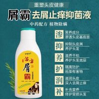 1瓶体验装[温和去屑] 洗发水控油去油去屑洗头膏除螨虫神器大块头皮屑头皮痒无硅油清爽