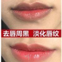 去嘴唇部去唇周边黑暗沉唇膜去黑色素嘴边学生嘴巴角唇纹精华护理 去嘴唇部去唇周边黑暗沉唇膜去黑色素嘴边学生嘴巴角唇纹精华护