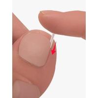 10片装 甲沟嵌甲炎正甲垫填充垫指甲往肉里扎专用垫片纠正往肉里长的指甲