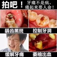 防蛀牙膏龋齿修复清理牙洞黑斑儿童虫牙菌斑祛除黑洗牙粉牙疼神器