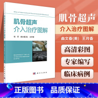 [正版]肌骨超声介入治疗图解 曲文春 王月香编著 精准超声影像引导下注射技术将成为临床治疗肌肉骨骼系统疾病的*要手段