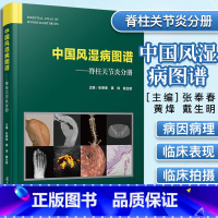 [正版]中国风湿病图谱脊柱关节炎分册 复旦大学出版社 脊柱病风湿性关节炎诊疗图谱 外科医学 9787309154238