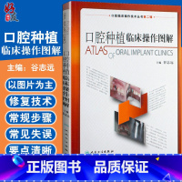 [正版]口腔种植临床操作图解 口腔临床操作技术丛书 谷志远主编 人民卫生出版社9787117129831