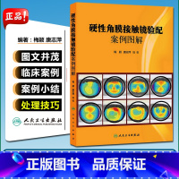 [正版] 硬性角膜接触镜验配案例图解 梅颖 唐志萍主编 人民卫生出版社 眼科学参考工具书籍眼角膜治疗图谱 978711