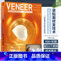 [正版]VENEER 瓷贴面修复技术 从标准到微创无预备 刘峰 口腔美学修复学实用教程口腔美学修复学书籍口腔美学书籍口腔