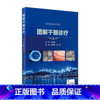 [正版]图解干眼诊疗 晋秀明徐雯主编 眼科学干眼症治疗干眼检查诊疗护理睑缘炎结膜角膜病变人民卫生出版社眼科书籍