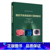 [正版]眼前节疾病裂隙灯图像解读实用学中华眼科特检照相技巧青光眼 角膜屈光手术并发症案例图解眼表疾病临床诊断视网膜医学