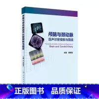 [正版]颅脑与颈动脉超声诊断模板与图谱 邢英琦 主编 内科学 9787117227575 2016年8月参考书 人