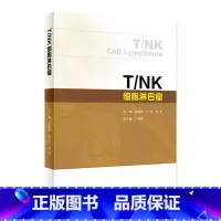 T/NK细胞淋巴瘤 2024年6月参考书 [正版]T/NK细胞淋巴瘤 2024年6月参考书