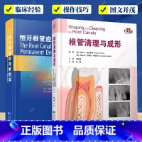 根管清理与成形+恒牙根管应用解剖学2册 [正版]根管清理与成形+恒牙根管应用解剖学2册 牙体牙髓根管解剖根管清理牙髓治疗