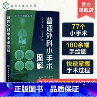 单本全册 [正版]普通外科小手术图解 赵毅 适应证术前准备麻醉方式手术步骤手术技巧和特别提示术后处理并发症 外科临床常用