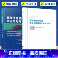 无托槽隐形矫治2册 [正版]无托槽隐形矫治常见失败病例及解决方案+无托槽隐形矫治中的难点与对策2册 口腔正畸书籍 无托槽