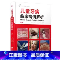 儿童牙病临床病例解析 第2版 [正版](单本任选)口腔医学书籍18册 牙髓疾病诊断治疗 根管外科手术操作 口腔检查与治疗