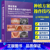 单本全册 [正版] 循证思维种植方案设计与操作技巧 关呈超 李静 伊哲 译 口腔科学书籍 口腔种植修复书籍 978755
