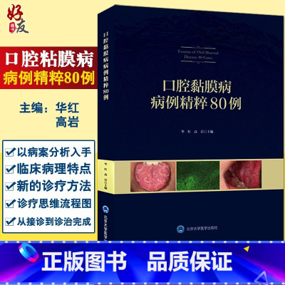 [正版] 口腔黏膜病病例精粹80例 华红 高岩主编 口腔黏膜疾病诊疗图解 口腔医学 口腔粘膜溃疡 北京大学医学出版