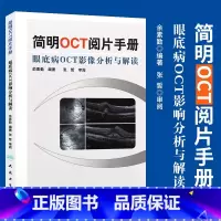 [正版] 简明OCT阅片手册 眼底病眼科OCT影像分析与解读 俞素勤编著 基础阅片影像眼科学视光技术应用 人民卫生出版